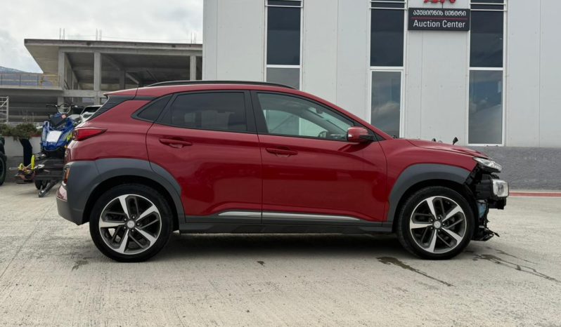 
								2018 Hyundai Kona full									